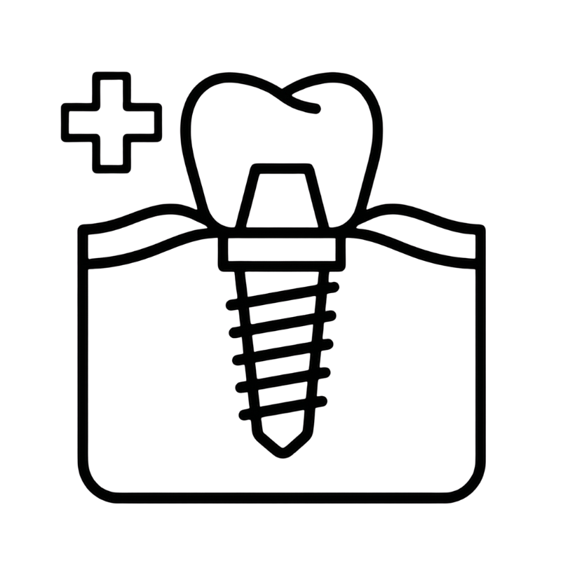 implantologiaAvanzata Implantologia avanzata